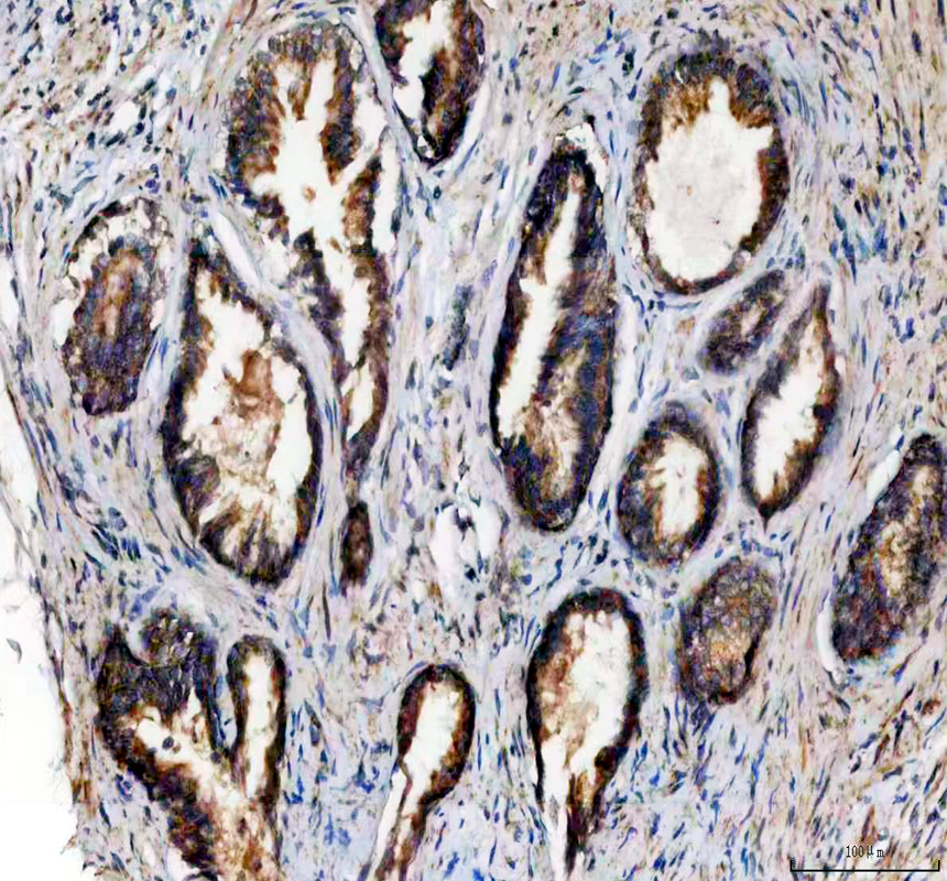 IHC analysis of NDUFA11 using anti-NDUFA11 antibody (A12604-1)