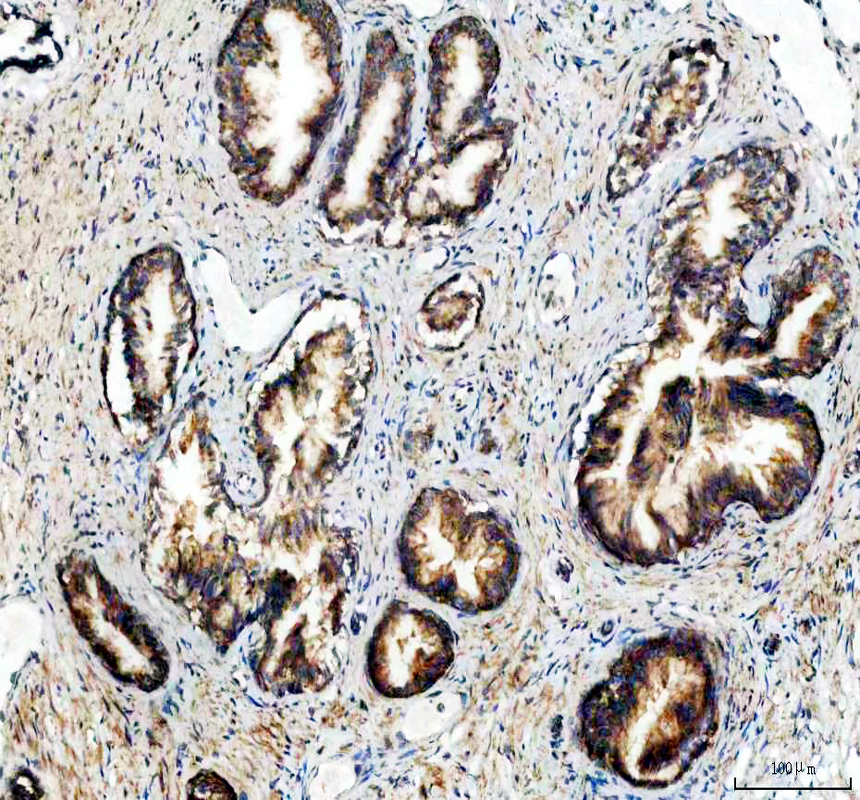 a12604 1 ndufa11 primary antibodies ihc testing 3
