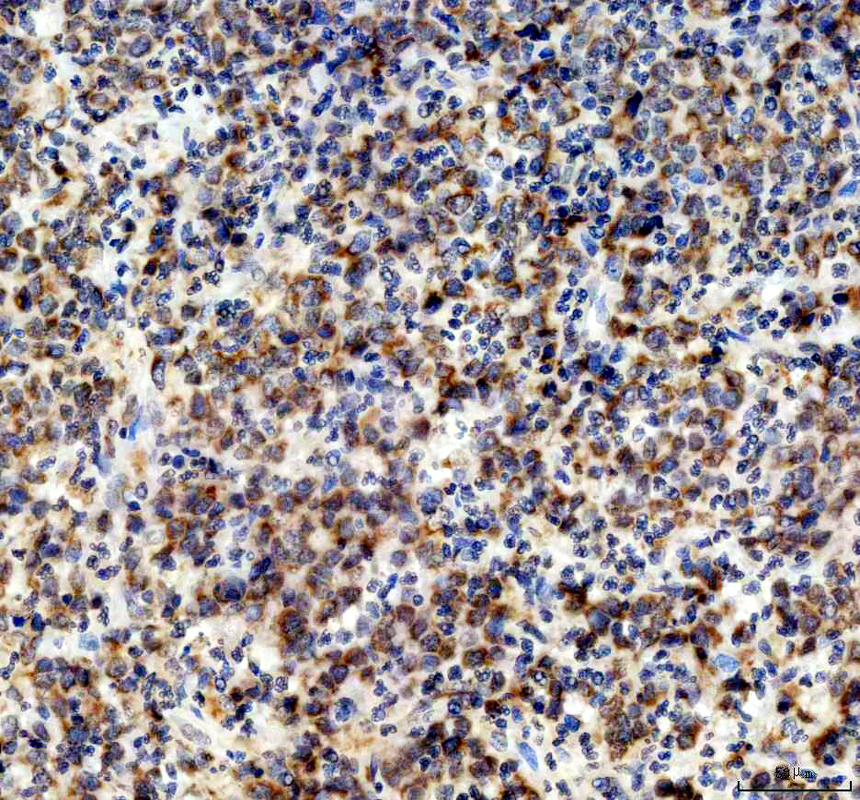 a12604 1 ndufa11 primary antibodies ihc testing 4