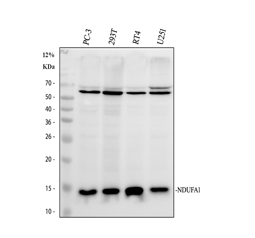 Western blot analysis of NDUFA11 using anti-NDUFA11 antibody (A12604-1)
