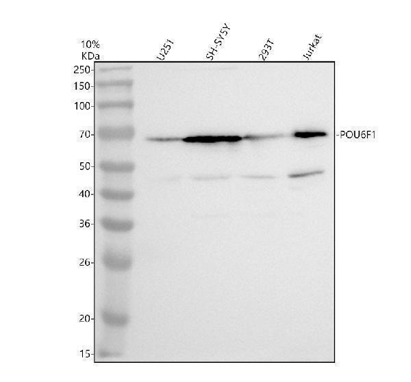 Western blot analysis of POU6F1 using anti-POU6F1 antibody (A12610-1)
