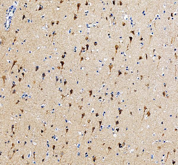 a12616 1 luzp1 primary antibodies ihc testing 1