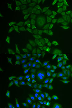 a12621 kyat1 primary antiboties if testing 2