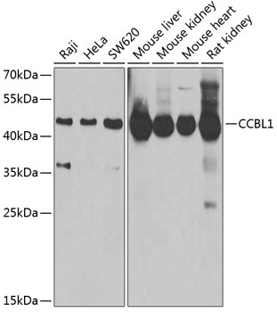a12621 kyat1 primary antiboties wb testing 1