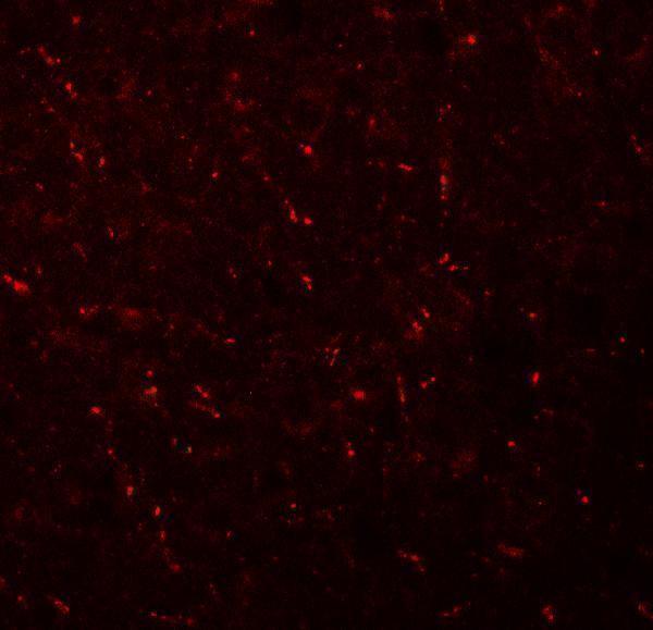 a12628 ap3m1 primary antibodies if testing 3
