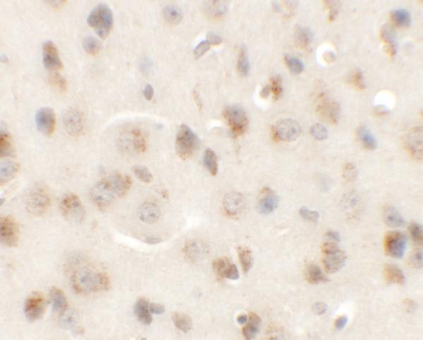 a12628 ap3m1 primary antibodies ihc testing 2