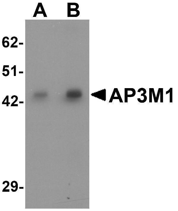 a12628 ap3m1 primary antibodies wb testing 1