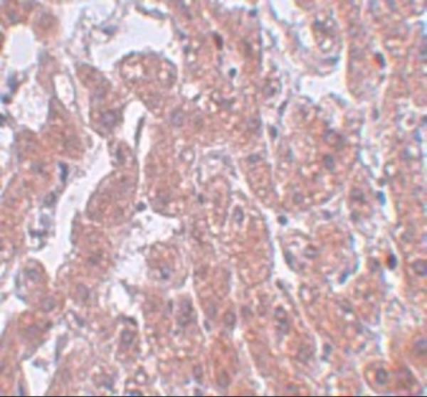 a12630 fam59a primary antibodies ihc testing 2