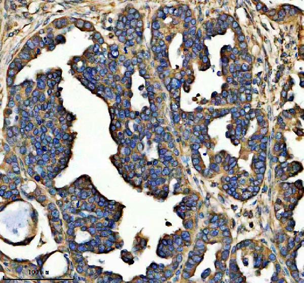 IHC analysis of CLEC14A using anti-CLEC14A antibody (A12642-2)