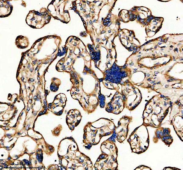IHC analysis of CLEC14A using anti-CLEC14A antibody (A12642-2)