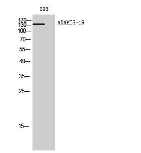 a12646 adamts19 primary antibodyes wb testing 1