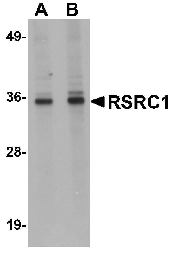 a12655 rsrc1 primary antibodies wb testing 1