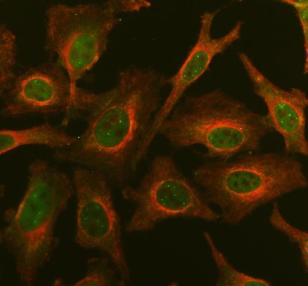 a12665 1 chchd1 primary antibodies if testing 1
