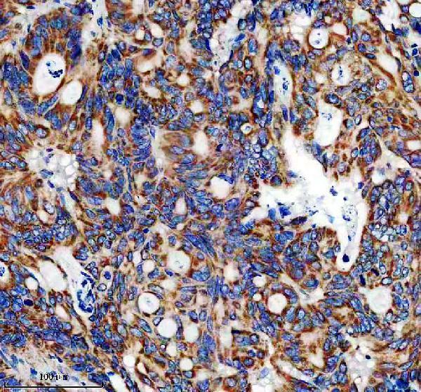 IHC analysis of CHCHD1 using anti-CHCHD1 antibody (A12665-1)
