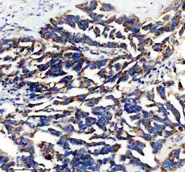 IHC analysis of CHCHD1 using anti-CHCHD1 antibody (A12665-1)