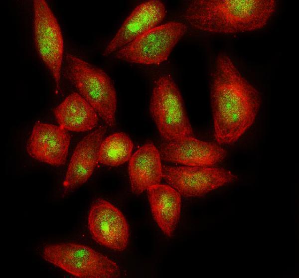 a12674 2 gipc3 primary antibodies if testing 2_1