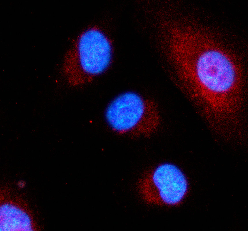 IF analysis of MAP3K15 using anti-MAP3K15 antibody (A12675-1)