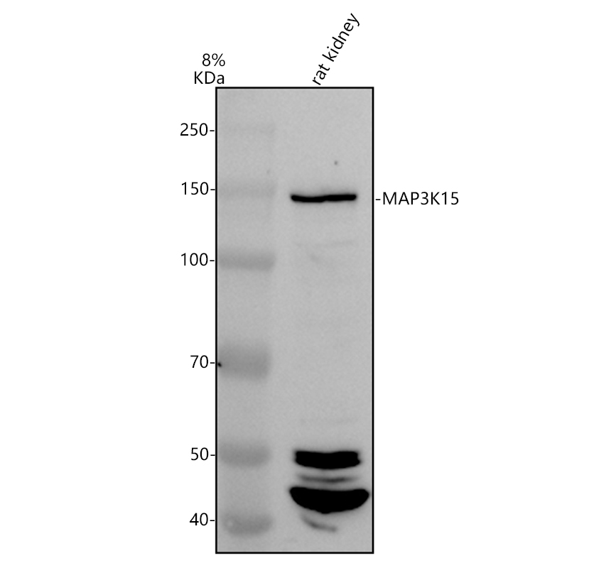 Western blot analysis of MAP3K15 using anti-MAP3K15 antibody (A12675-1)