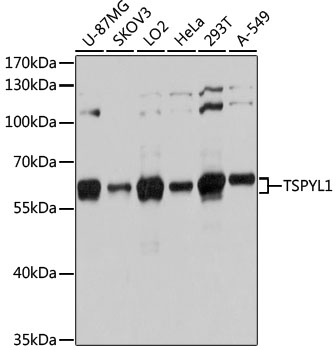 a12677 tspyl1 primary antiboties wb testing 1