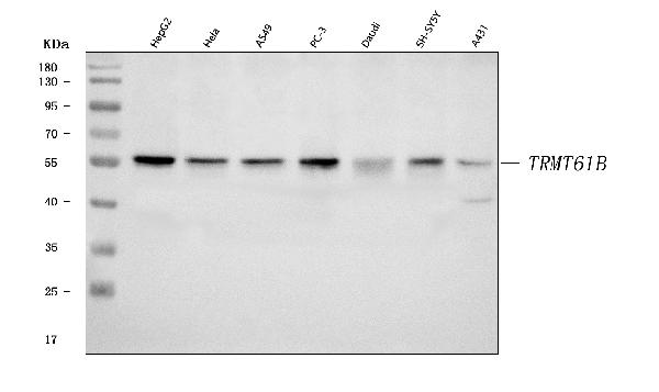 Figure 1. Western blot analysis of TRMT61B using anti-TRMT61B antibody (A12682-2). Electrophoresis was performed on a 5-20% SDS-PAGE gel at 70V (Stacking gel) / 90V (Resolving gel) for 2-3 hours. The sample well of each lane was loaded with 30 ug of sample under reducing conditions. Lane 1: human HepG2 whole cell lysates, Lane 2: human Hela whole cell lysates, Lane 3: human A549 whole cell lysates, Lane 4: human PC-3 whole cell lysates, Lane 5: human Daudi whole cell lysates, Lane 6: human SH-SY5Y whole cell lysates, Lane 7: human A431 whole cell lysates. After electrophoresis, proteins were transferred to a nitrocellulose membrane at 150 mA for 50-90 minutes. Blocked the membrane with 5% non-fat milk/TBS for 1.5 hour at RT. The membrane was incubated with rabbit anti-TRMT61B antigen affinity purified polyclonal antibody (Catalog # A12682-2) at 0.5 microg/mL overnight at 4°C, then washed with TBS-0.1%Tween 3 times with 5 minutes each and probed with a goat anti-rabbit IgG-HRP secondary antibody at a dilution of 1:5000 for 1.5 hour at RT. The signal is developed using an Enhanced Chemiluminescent detection (ECL) kit (Catalog # EK1002) with Tanon 5200 system. A specific band was detected for TRMT61B at approximately 57 kDa. The expected band size for TRMT61B is at 53 kDa.