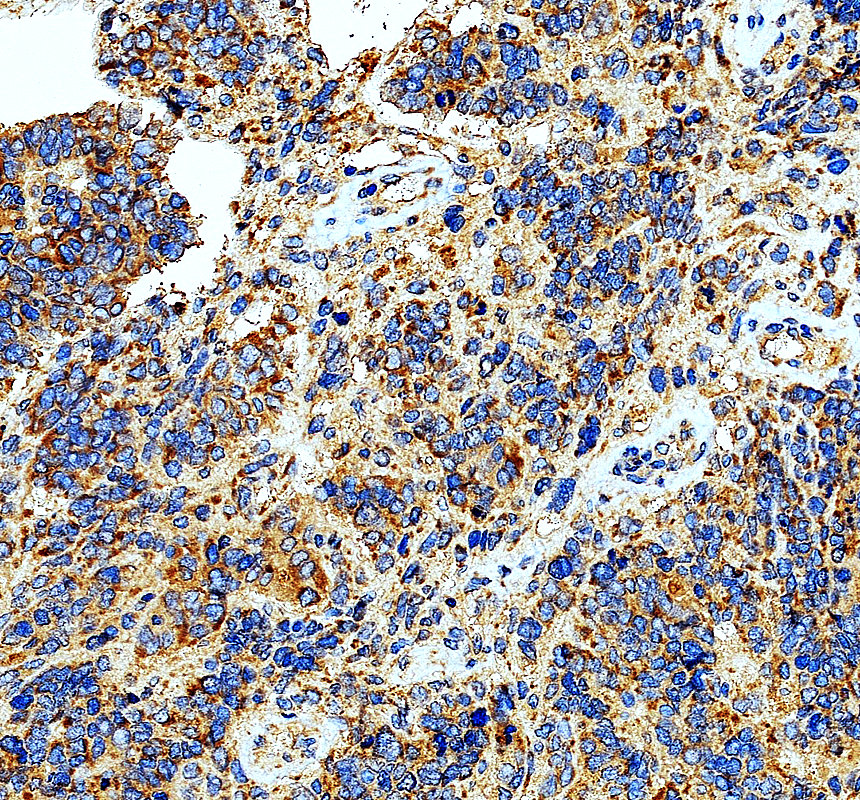 IHC analysis of MRPL3 using anti-MRPL3 antibody (A12688-1)