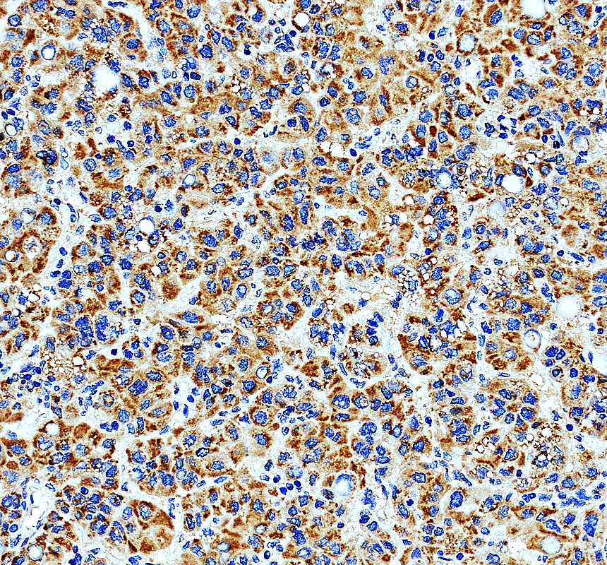 IHC analysis of MRPL3 using anti-MRPL3 antibody (A12688-1)