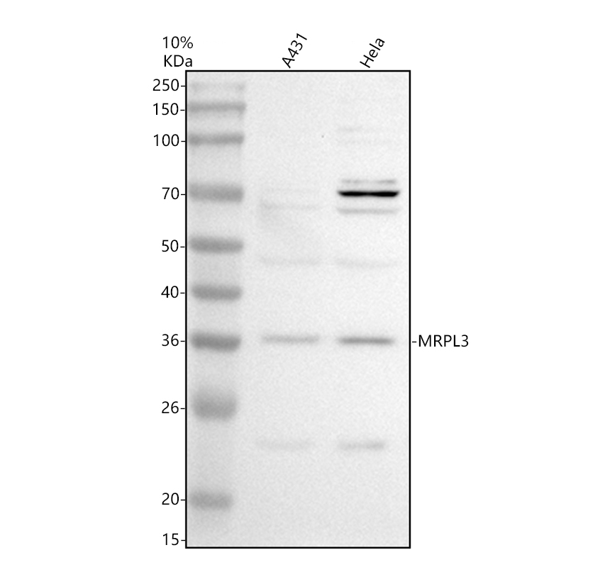 Western blot analysis of MRPL3 using anti-MRPL3 antibody (A12688-1)
