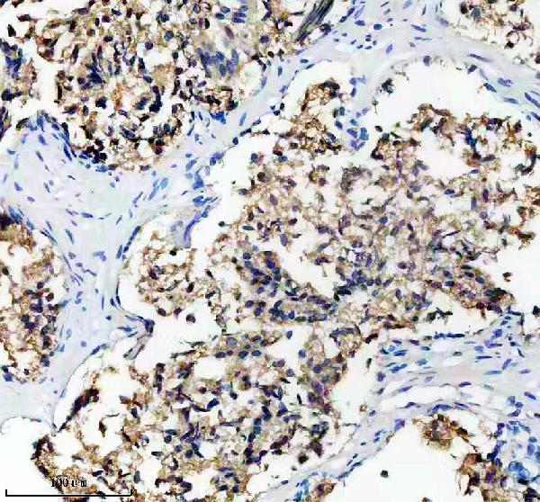 IHC analysis of DHRS7 using anti-DHRS7 antibody (A12691-1)