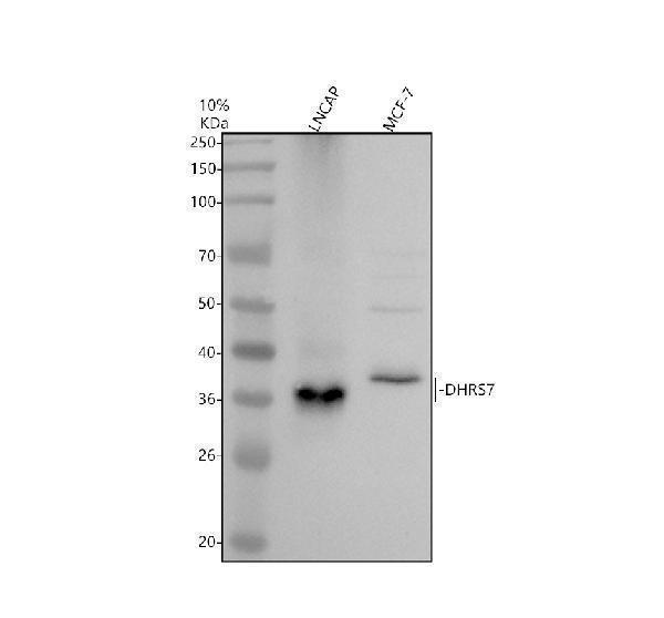 Western blot analysis of DHRS7 using anti-DHRS7 antibody (A12691-1)
