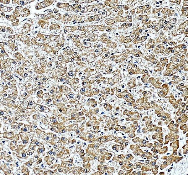 IHC analysis of TJAP1 using anti-TJAP1 antibody (A12692-1)