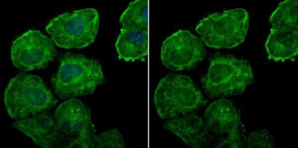 ICC staining Galectin 7 in HUVEC cells (green)