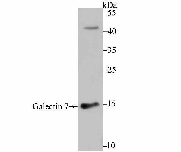 Western blot analysis of Galectin 7 on human skin tissue lysate using anti-Galectin 7 antibody at 1/500 dilution