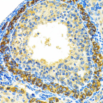 Immunohistochemistry of paraffin-embedded rat ovary using MRPL28 antibody  at dilution of 1:100 