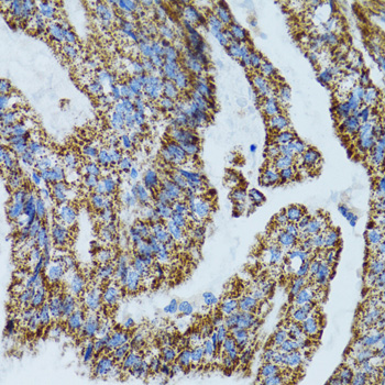a12699 1 mrpl28 primary antiboties ihc testing 4