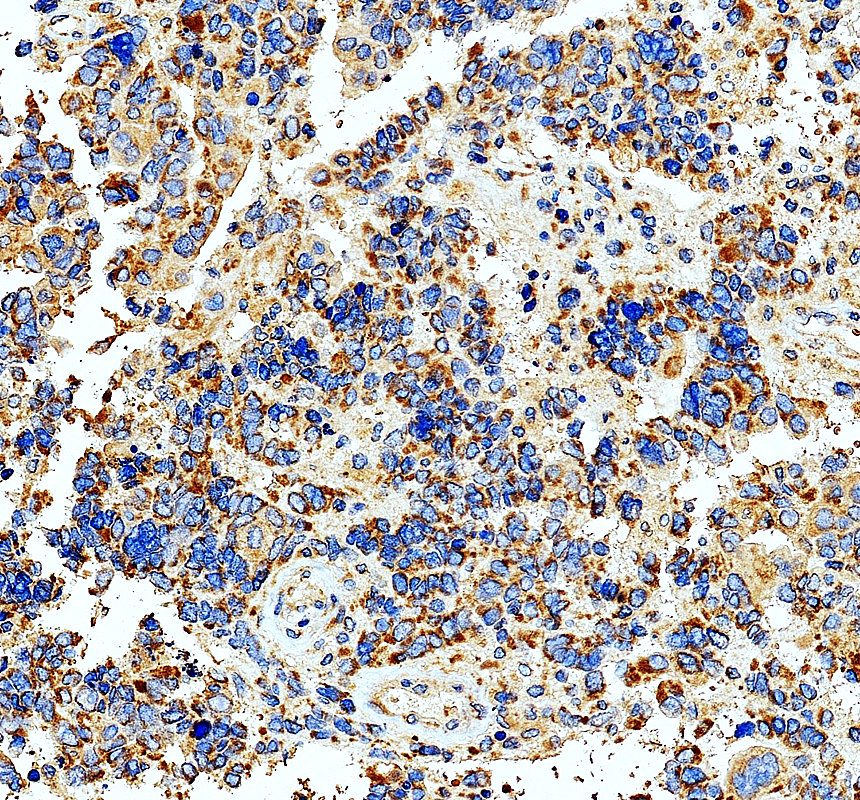 IHC analysis of MRPL28 using anti-MRPL28 antibody (A12699-2)