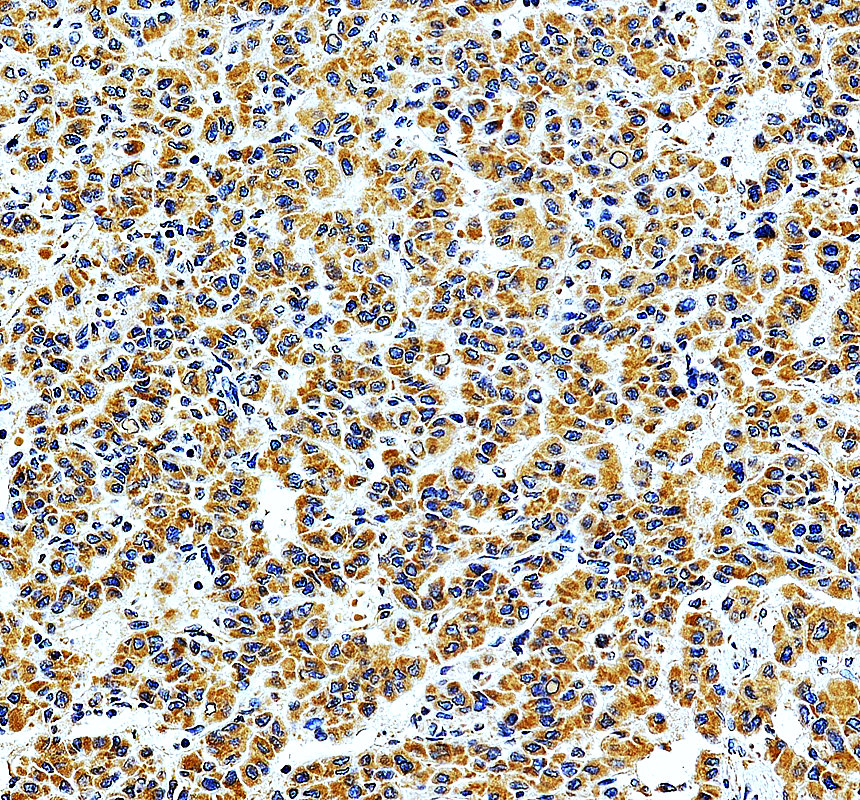 IHC analysis of MRPL28 using anti-MRPL28 antibody (A12699-2)