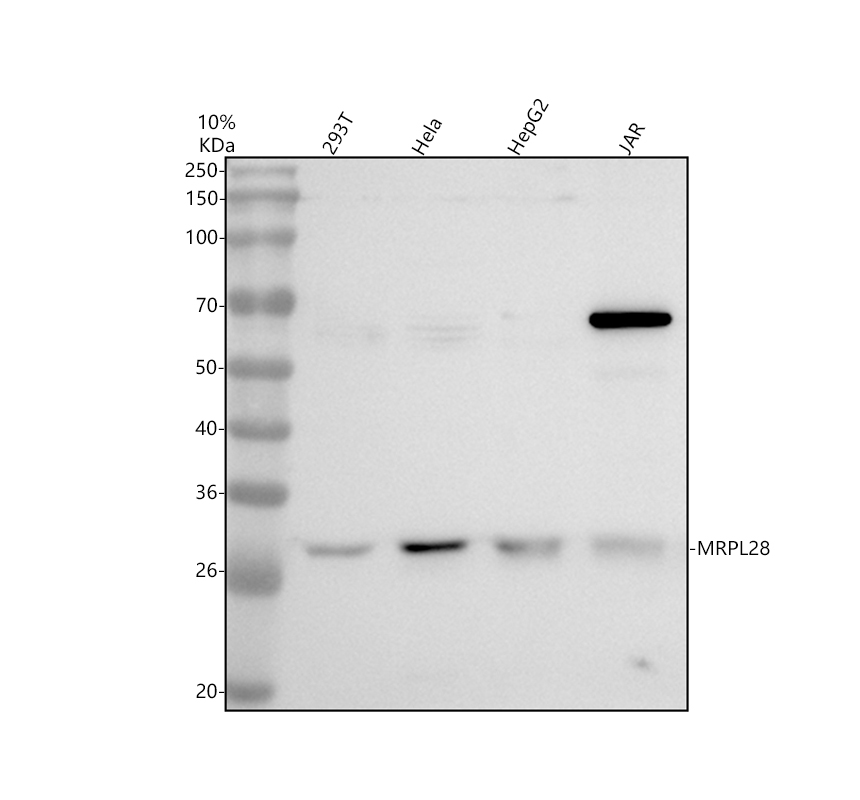 Western blot analysis of MRPL28 using anti-MRPL28 antibody (A12699-2)