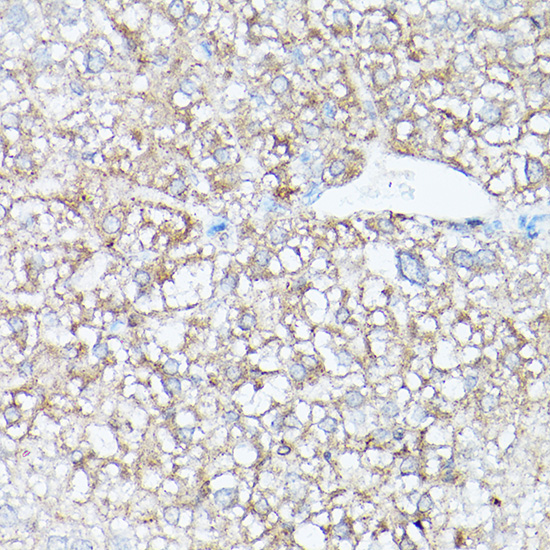 Immunofluorescence analysis of human liver cells using HSD17B13 Rabbit pAb  at dilution of 1:25 