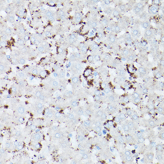 a12700 hsd17b13 primary antiboties ihc testing 3