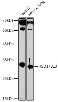 Western blot analysis of extracts of various cell lines, using HSD17B13 antibody  at 1:1000 dilution