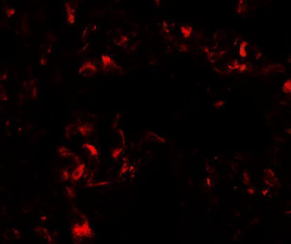a12703 foxred2 primary antibodies if testing 2
