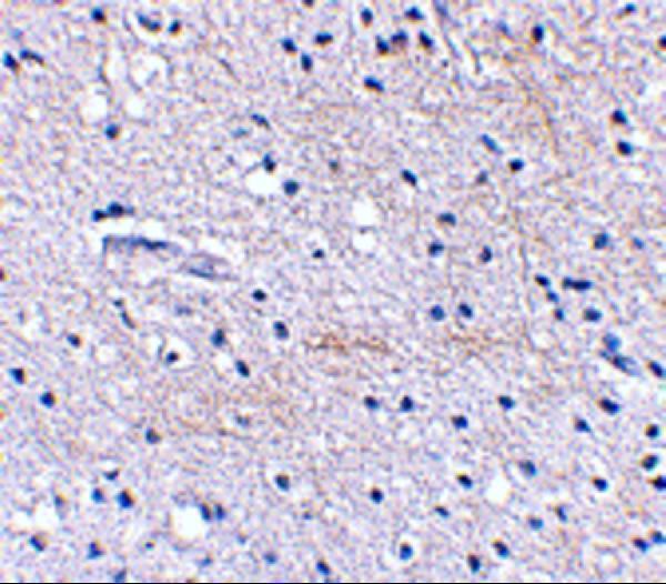 a12714 fbxl20 primary antibodies ihc testing 2