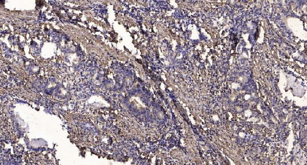 a12719 znhit6 primary antibodies ihc testing 1