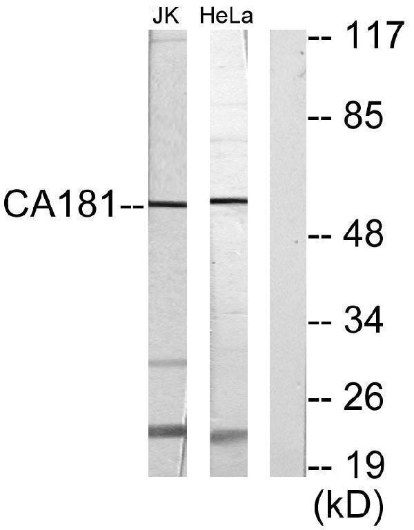 a12719 znhit6 primary antibodies wb testing 2
