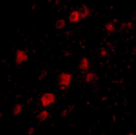 Immunofluorescence of POLR3F in human brain tissue with POLR3F antibody at 20 μg/mL