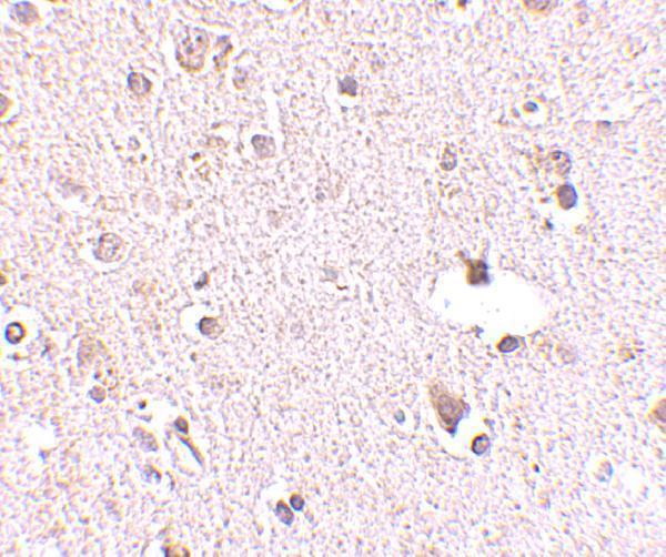 Immunohistochemistry of POLR3F in human brain tissue with POLR3F antibody at 2