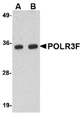 Western blot analysis of POLR3F in human brain tissue lysate with POLR3F antibody at (A) 0