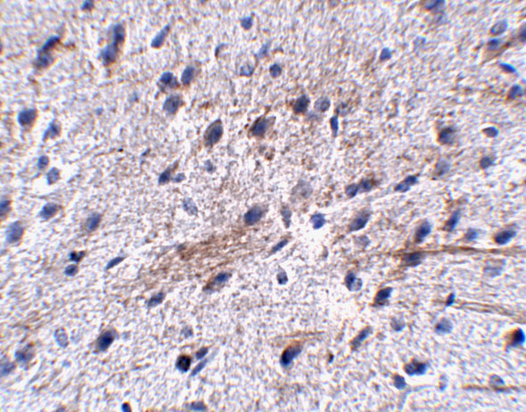 a12727 lrfn5 primary antibodies ihc testing 2