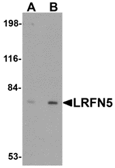 a12727 lrfn5 primary antibodies wb testing 1