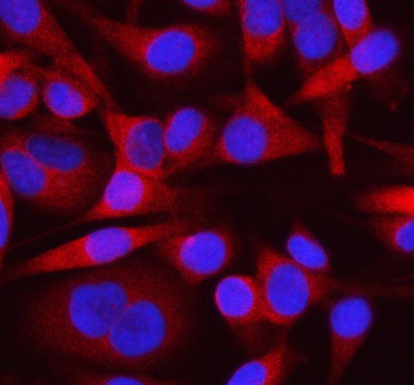 Figure 2. IF analysis of OTUD3 using anti-OTUD3 antibody (A12734). OTUD3 was detected in an immunocytochemical section of HELA cells. Enzyme antigen retrieval was performed using IHC enzyme antigen retrieval reagent (AR0022) for 15 mins. The cells were blocked with 10% goat serum. And then incubated with 5 microg/mL rabbit anti-OTUD3 Antibody (A12734) overnight at 4°C. Cy3 Conjugated Goat Anti-Rabbit IgG (BA1032) was used as secondary antibody at 1:500 dilution and incubated for 30 minutes at 37°C. The section was counterstained with DAPI. Visualize using a fluorescence microscope and filter sets appropriate for the label used. Figure 2. IF analysis of OTUD3 using anti-OTUD3 antibody (A12734). OTUD3 was detected in an immunocytochemical section of HELA cells. Enzyme antigen retrieval was performed using IHC enzyme antigen retrieval reagent (AR0022) for 15 mins. The cells were blocked with 10% goat serum. And then incubated with 5 microg/mL rabbit anti-OTUD3 Antibody (A12734) overnight at 4°C. Cy3 Conjugated Goat Anti-Rabbit IgG (BA1032) was used as secondary antibody at 1:500 dilution and incubated for 30 minutes at 37°C. The section was counterstained with DAPI. Visualize using a fluorescence microscope and filter sets appropriate for the label used.